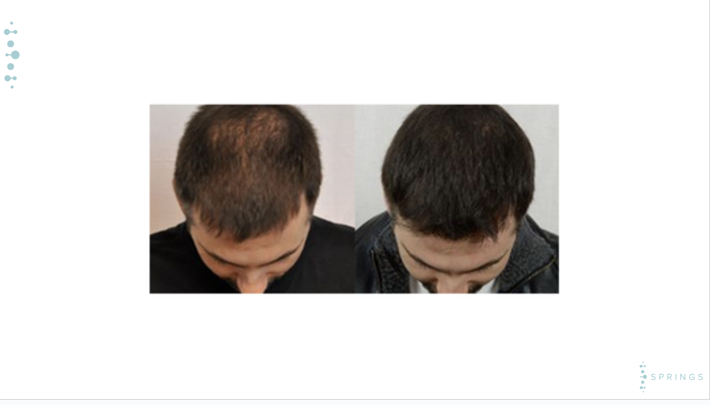 Before and After Results